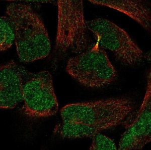 Anti-PKNOX2 antibody produced in rabbit 