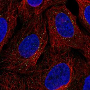 Anti-PLA2G12B antibody produced in rabbit 