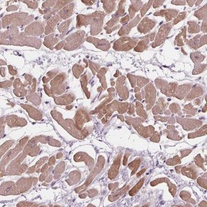 Anti-PLA2G2E antibody produced in rabbit 