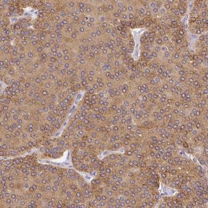 Anti-PLA2G4A antibody produced in rabbit 