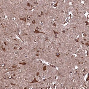 Anti-PLA2G4C antibody produced in rabbit 