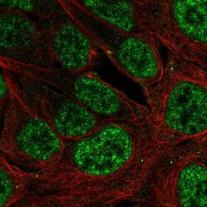 Anti-PLAG1 antibody produced in rabbit 
