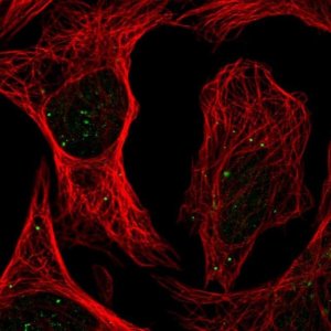 Anti-PLAGL1 antibody produced in rabbit 