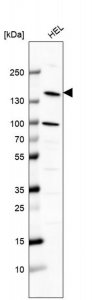 Anti-PLCB2 antibody produced in rabbit 