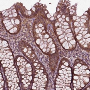 Anti-PLCD3 antibody produced in rabbit 