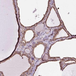 Anti-PLCG1 antibody produced in rabbit 