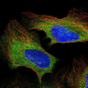 Anti-PLCG1 antibody produced in rabbit 