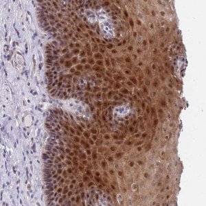 Anti-PLCL2 antibody produced in rabbit 
