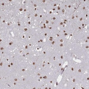 Anti-PLEKHG5 antibody produced in rabbit 