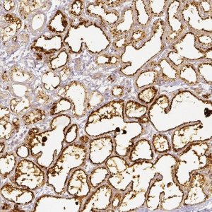 Anti-PLIN2 antibody produced in rabbit 