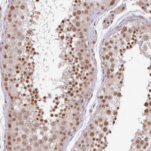 Anti-PLK1 antibody produced in rabbit 