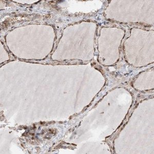 Anti-PLPP3 antibody produced in rabbit 