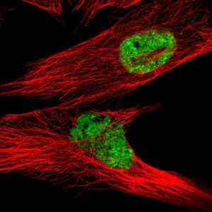 Anti-PLPPR2 antibody produced in rabbit 