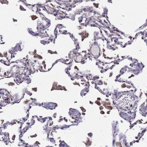 Anti-PLXDC2 antibody produced in rabbit 