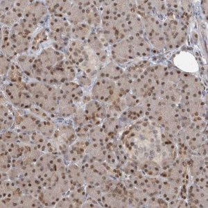 Anti-PMM1 antibody produced in rabbit HPA030712-100UL
