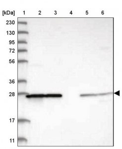 Anti-PMM1 antibody produced in rabbit HPA030712-100UL
