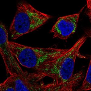 Anti-PMPCB antibody produced in rabbit 