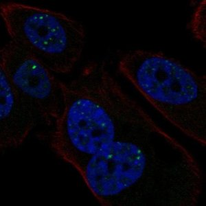 Anti-PMS1 antibody produced in rabbit 
