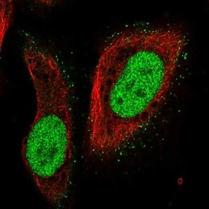 Anti-PMS2 antibody produced in rabbit 