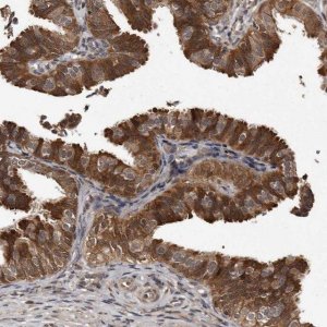 Anti-PMVK antibody produced in rabbit 
