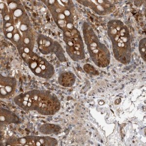 Anti-PMVK antibody produced in rabbit 