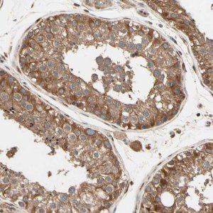 Anti-PNCK antibody produced in rabbit 