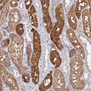 Anti-PNISR antibody produced in rabbit 