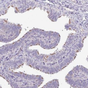 Anti-PNLDC1 antibody produced in rabbit 