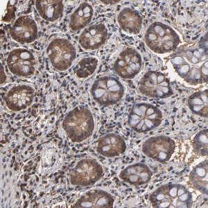 Anti-PNPLA4 antibody produced in rabbit HPA003656-100UL