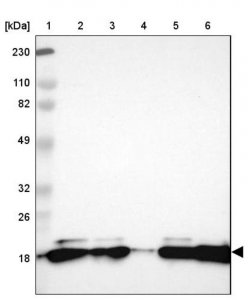 Anti-PNPLA4 antibody produced in rabbit HPA003656-100UL