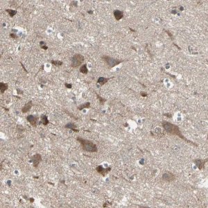 Anti-PNPLA7 antibody produced in rabbit 
