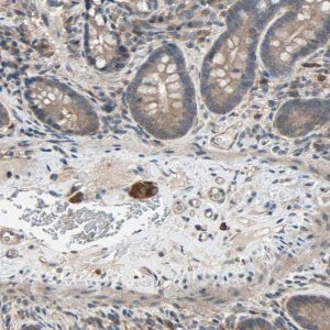 Anti-PNPLA7 antibody produced in rabbit 
