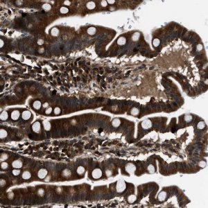 Anti-PNPLA8 antibody produced in rabbit 