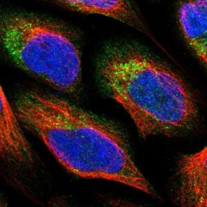 Anti-PNPLA8 antibody produced in rabbit 