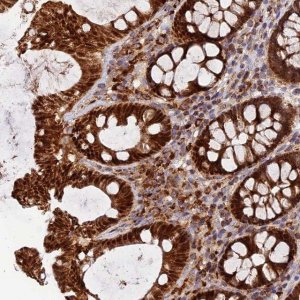 Anti-PODNL1 antibody produced in rabbit 