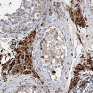 Anti-POLG2 antibody produced in rabbit 