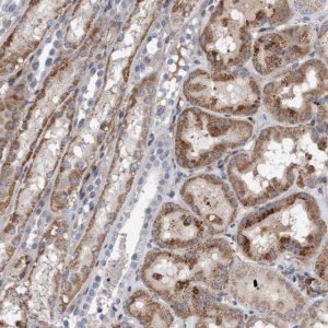 Anti-POLG2 antibody produced in rabbit 
