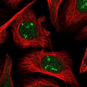 Anti-POLR1A antibody produced in rabbit 