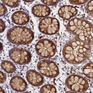 Anti-POM121 antibody produced in rabbit 