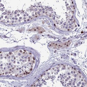 Anti-POM121L2 antibody produced in rabbit 