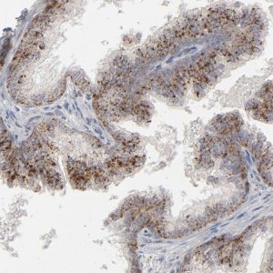 Anti-POMT2 antibody produced in rabbit HPA003663-100UL