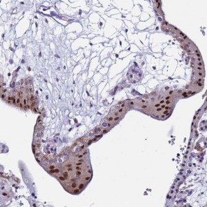 Anti-POP5 antibody produced in rabbit 