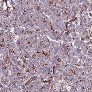 Anti-POTEE antibody produced in rabbit 