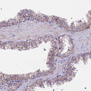 Anti-POTEE antibody produced in rabbit 