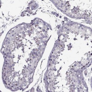 Anti-PP2D1 antibody produced in rabbit 