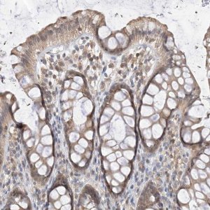 Anti-PPA2 antibody produced in rabbit 