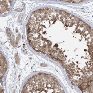 Anti-PPAT antibody produced in rabbit 