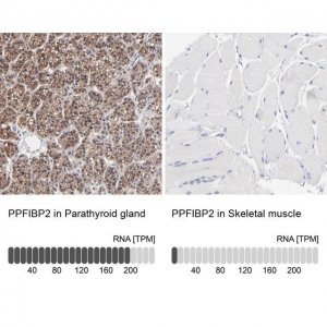 Anti-PPFIBP2 antibody produced in rabbit 
