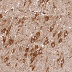 Anti-PPIP5K2 antibody produced in rabbit 