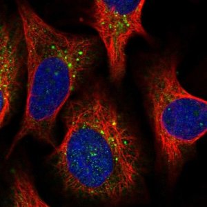 Anti-PPIP5K2 antibody produced in rabbit 